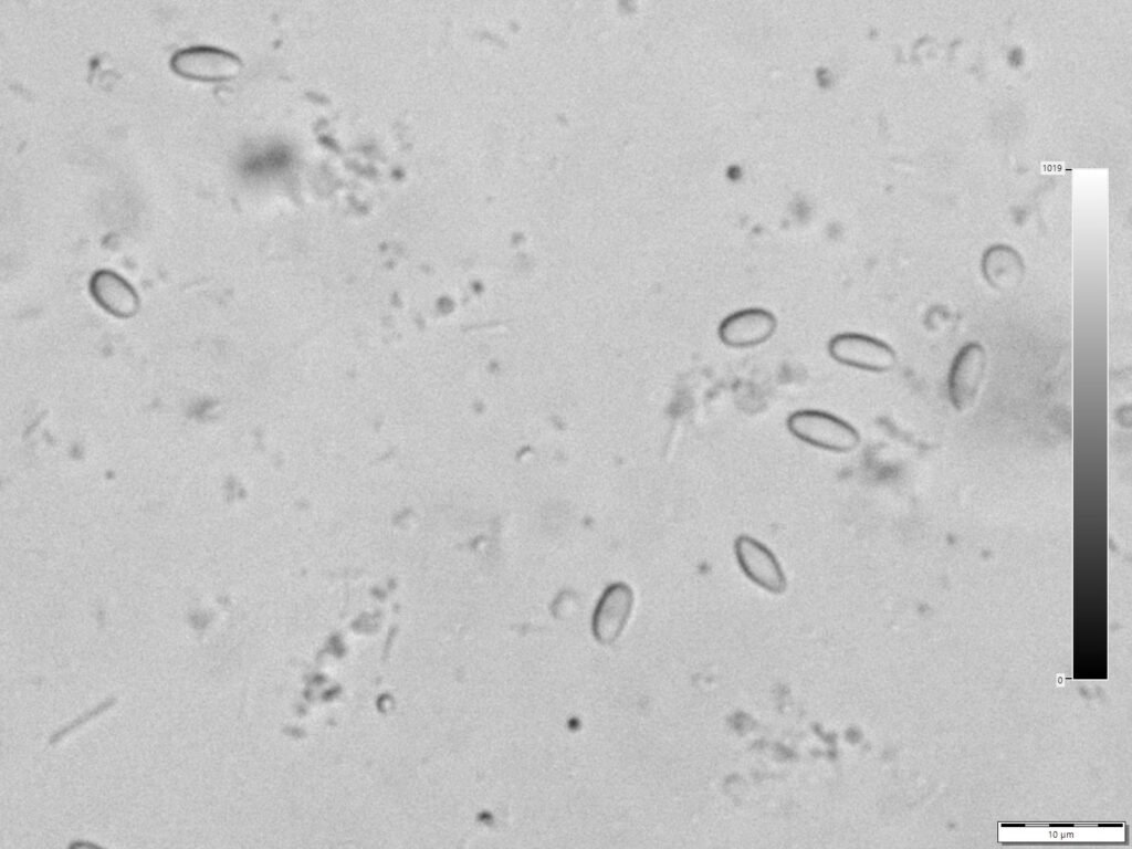 Microscope photo of oval Nosema spores from a honey bee gut sample magnified 1000 times