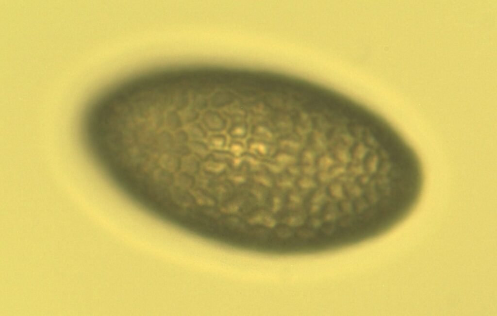 Microscope photo of a single canola (Brassica napus) pollen grain at 400x, showing its netted surface