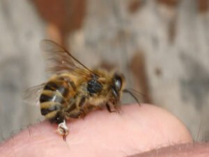 Honey bee stinging a human finger with the barbed stinger left in the skin