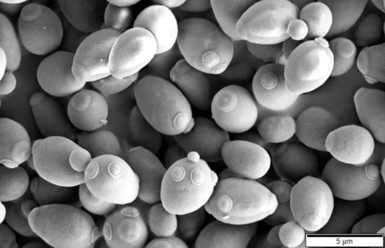 Scanning electron microscope image of Saccharomyces cerevisiae yeast cells budding, the organism responsible for fermenting mead