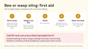 Infographic of five first-aid steps for a bee or wasp sting, with a red box listing anaphylaxis signs that mean call 911