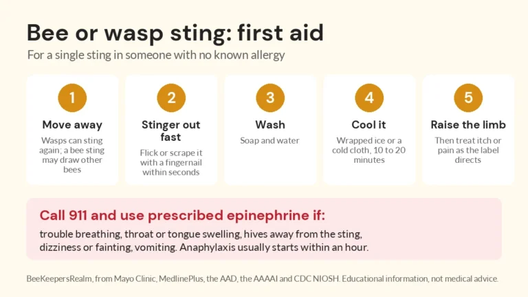 Infographic of five first-aid steps for a bee or wasp sting, with a red box listing anaphylaxis signs that mean call 911