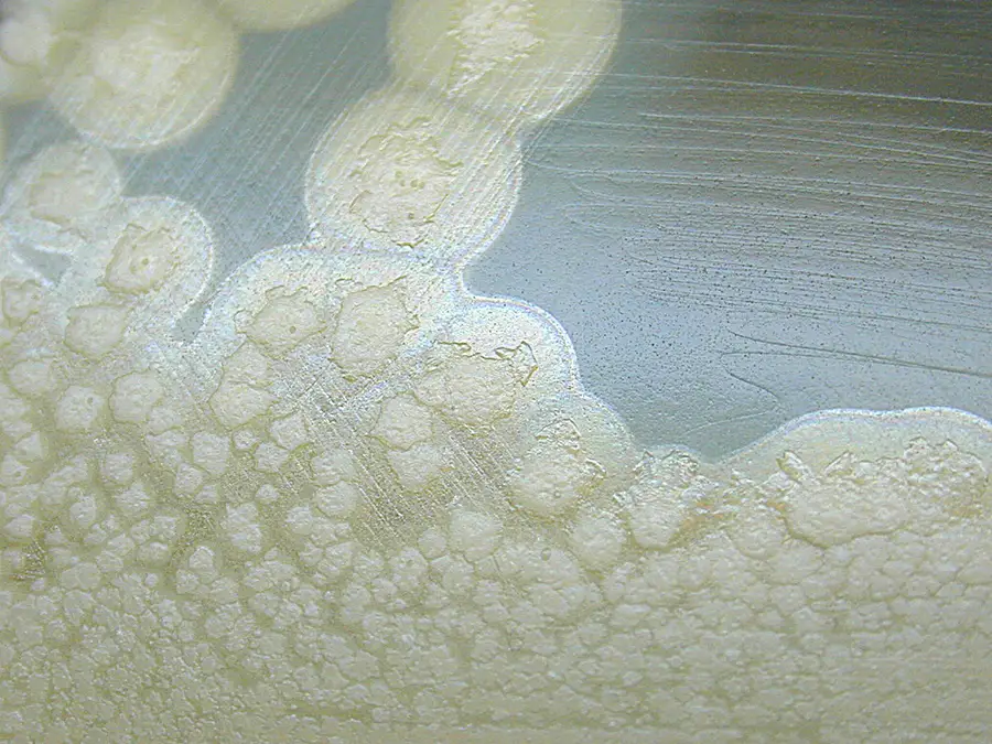 Lab culture of Clostridium botulinum colonies growing on egg yolk agar, the bacterium behind botulism